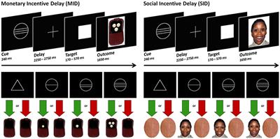 Functional connectivity in a monetary and social incentive delay task in medicated patients with schizophrenia